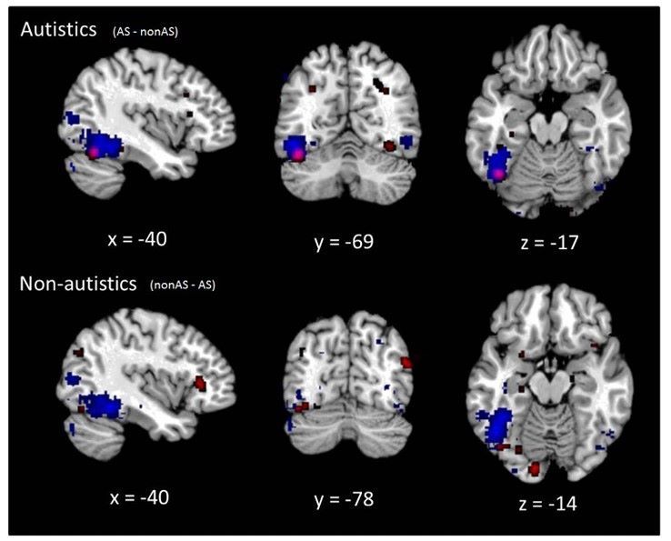 기능적 자기공명영상(fMRI) 사진으로 본 과독증을 가진 사람의 독해와 전형적인 문해자의 독해 비교.(사진=신경과학 및 생체행동학 리뷰) 